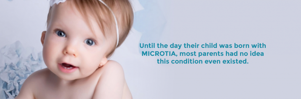 child with microtia