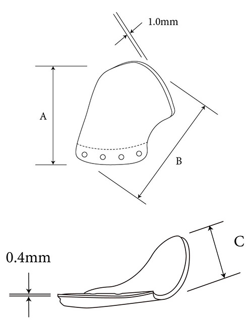 3d orbital floor implant diagram