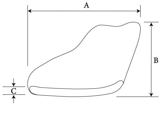 Lateral Augmentation Mandible diagram 