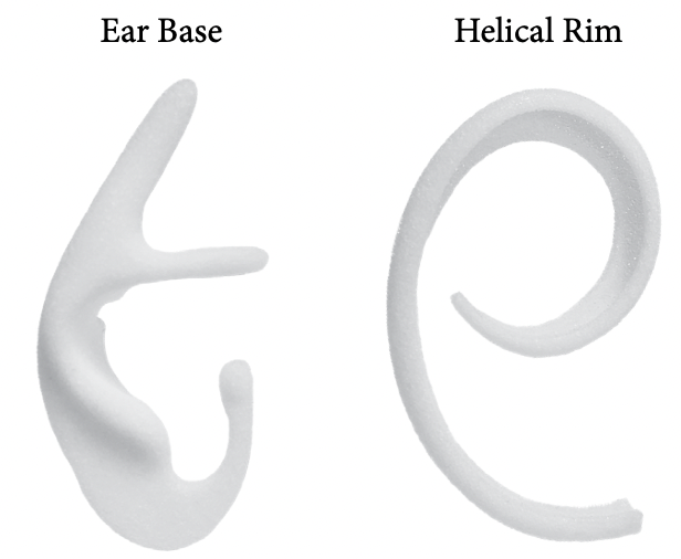 Two-Piece Auricular Implant