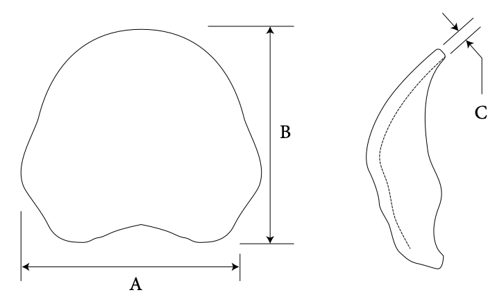 Occipital diagram