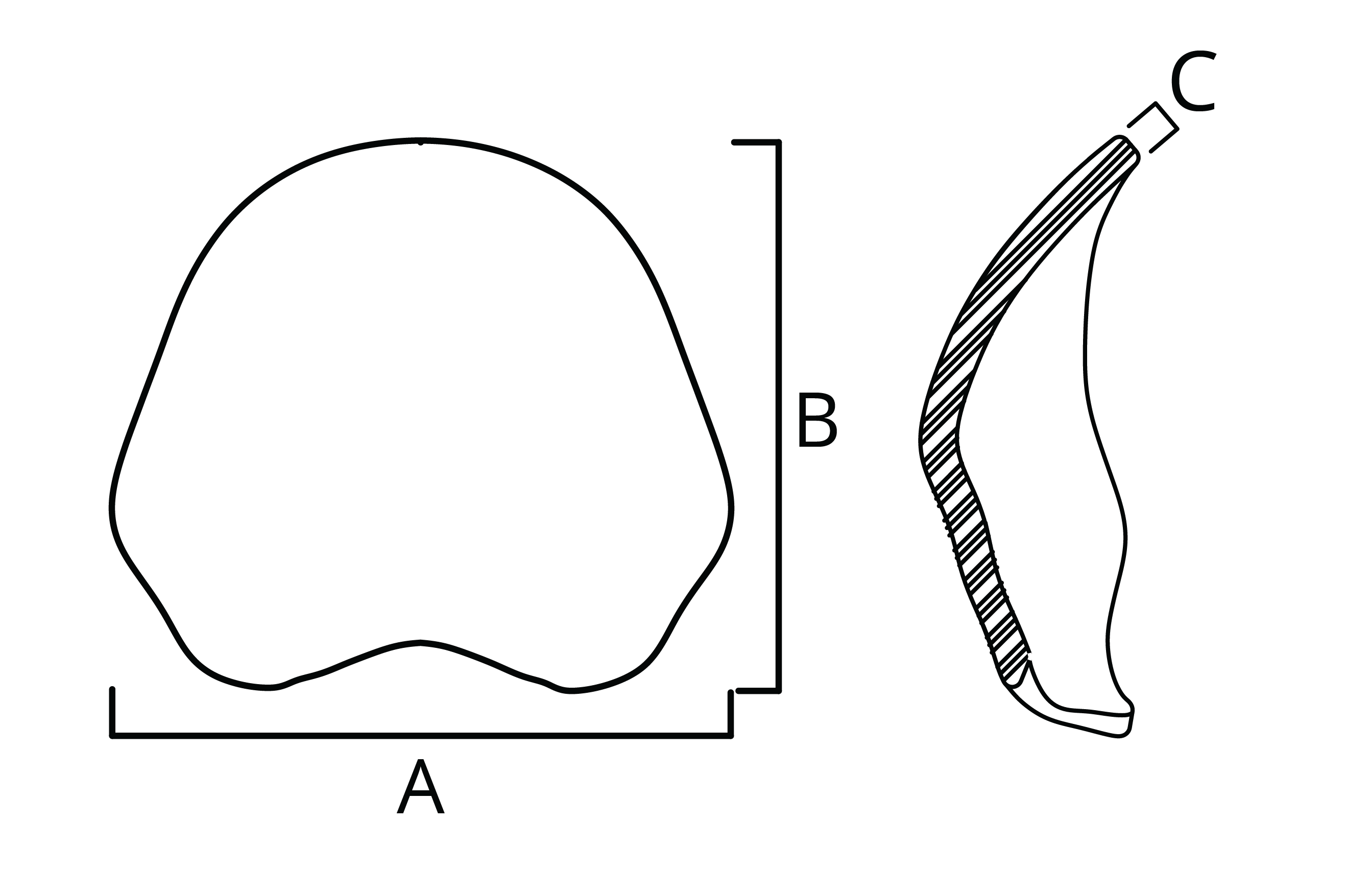 All Implant Diagrams-08