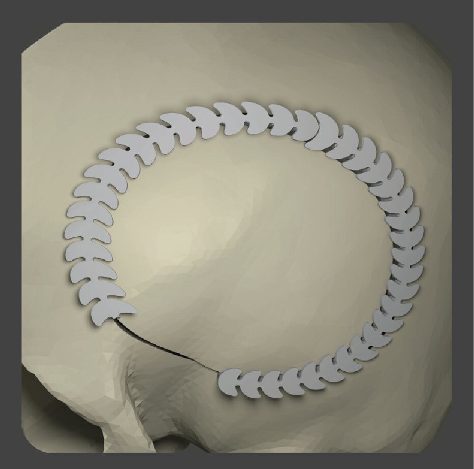 Curved white strip implant for filling surgical gaps
