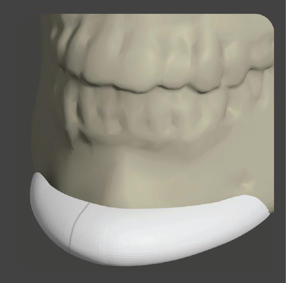 sadd-07 White curved chin implant with European-style contouring