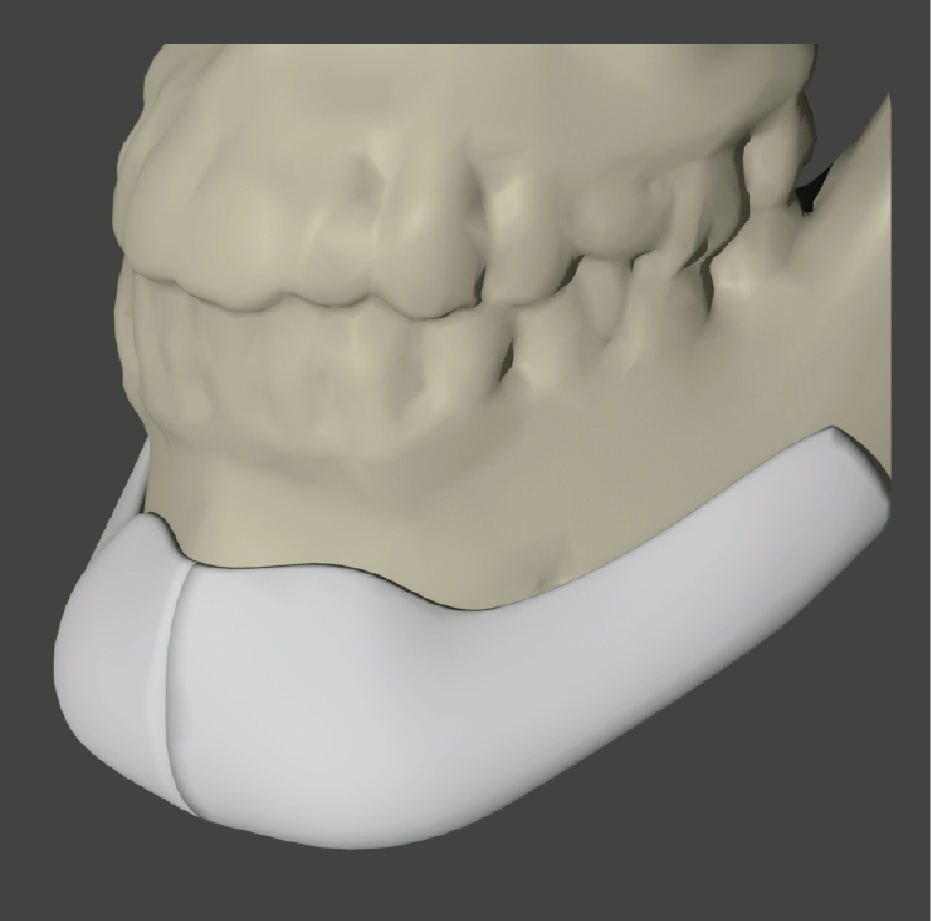 sadd-09 4263-1-Square Extended Chin