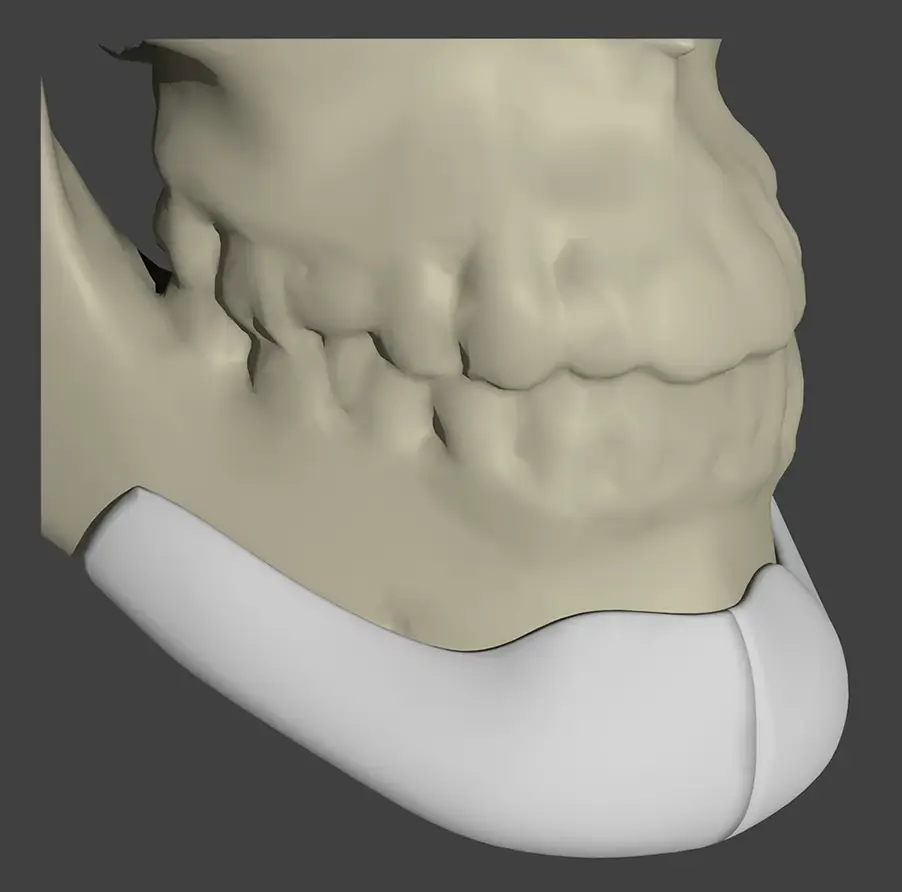 Round-Extended-Chin-rev Round Extended Chin